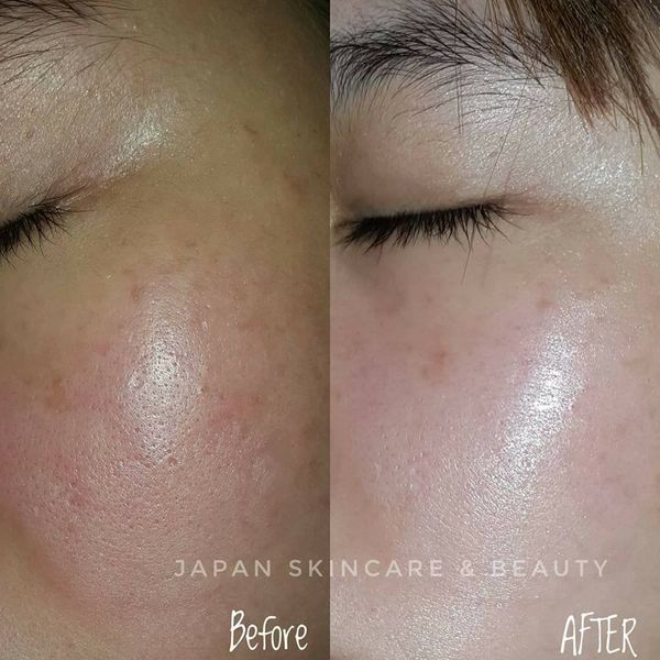 Reviews Viên uống collagen tươi của Nhật