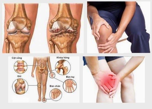 Viên uống điều trị xương khớp Dear Natura Glucosamine Collagen Nhật Bản