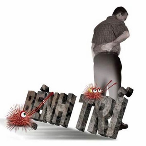 các giai đoạn của bệnh trĩ
