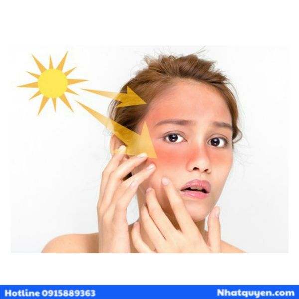 kien_thuc_ve_kem_chong_nang_727b12bc43e7417386df1a5ccada9925_grande