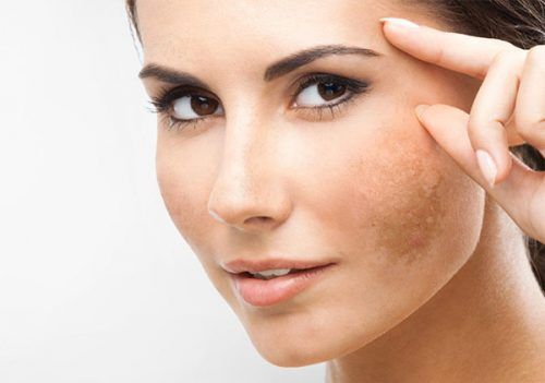 nammm_grande Review Serum nhau thai cao cấp Mediuse Cpla Whitening Nhật Bản