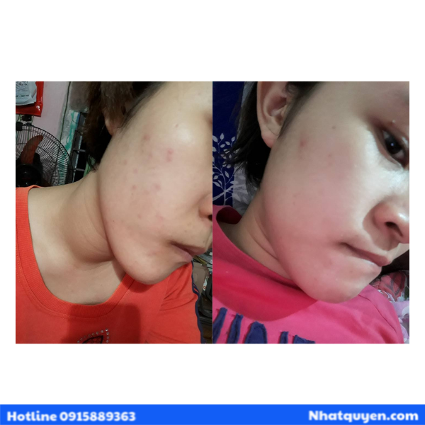 serum_tri_tham_cc_melano__2__982516e3d516424a927700ea1547f59e_grande