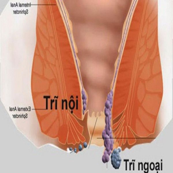 thuoc tri benh tri