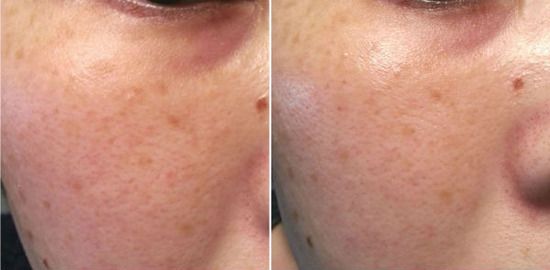 trang_da_a5c0ee59fe694dccb17733f1dcdb498c_grande Review Serum nhau thai cao cấp Mediuse Cpla Whitening Nhật Bản