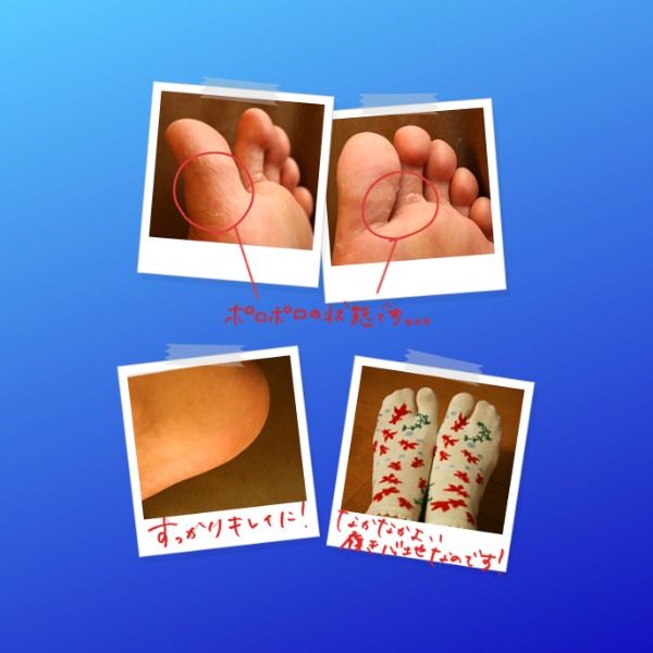 tri_nam_chan_tay_5_50bd82ea9e644fe6b414148173c0aa60_grande Hisamitsu
