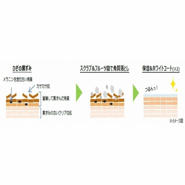 tri_tham_dau_goi3_578ac57fc07048129d6ed78681a94dd2_grande Kem trị thâm đầu gối cao cấp Nhật Bản Shiro Hiza Hime