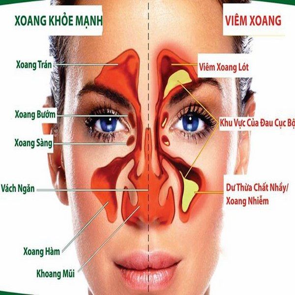 viem da xoang