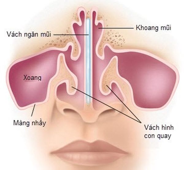viem_xoang_an_gi_tot_grande Chế độ ăn uống của người bị viêm xoang