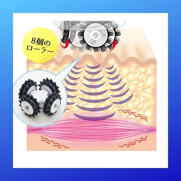 Máy massage giảm béo Ya-Man Acetino Advance Nhật Bản