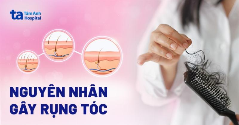 Hình ảnh minh họa da đầu bị nấm với các triệu chứng như ngứa, bong tróc, và tóc rụng nhiều, nhấn mạnh sự khó chịu của bệnh nấm da đầu