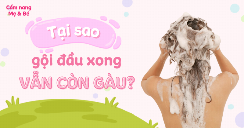 Minh họa các bước sử dụng dầu gội trị nấm da đầu đúng cách, bao gồm làm ướt, thoa dầu, massage, và xả sạch, giúp người dùng dễ dàng làm theo.