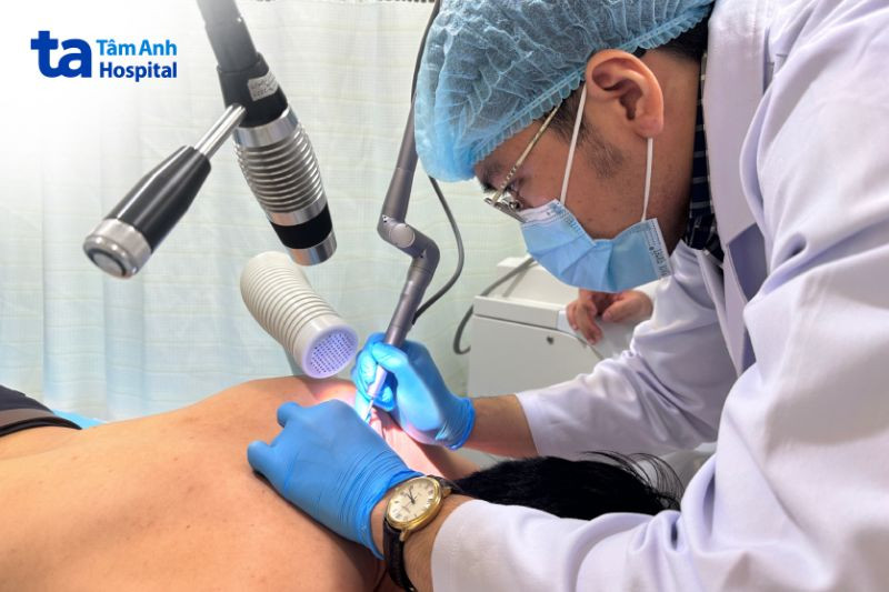 Bác sĩ điều trị rạn da cho khách hàng