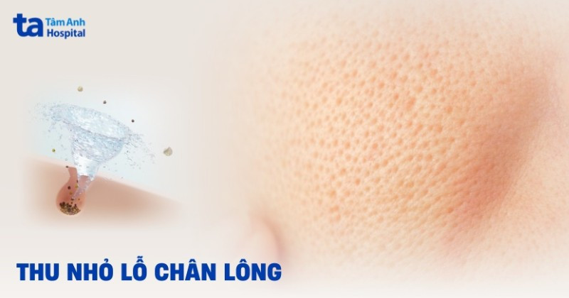 thu nhỏ lỗ chân lông